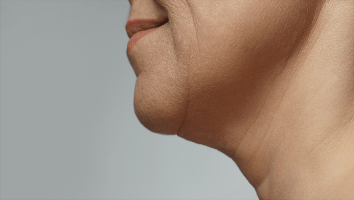 Side profile of a person's chin and neck.