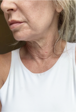 A person in a white tank top showing their neck and lower face.