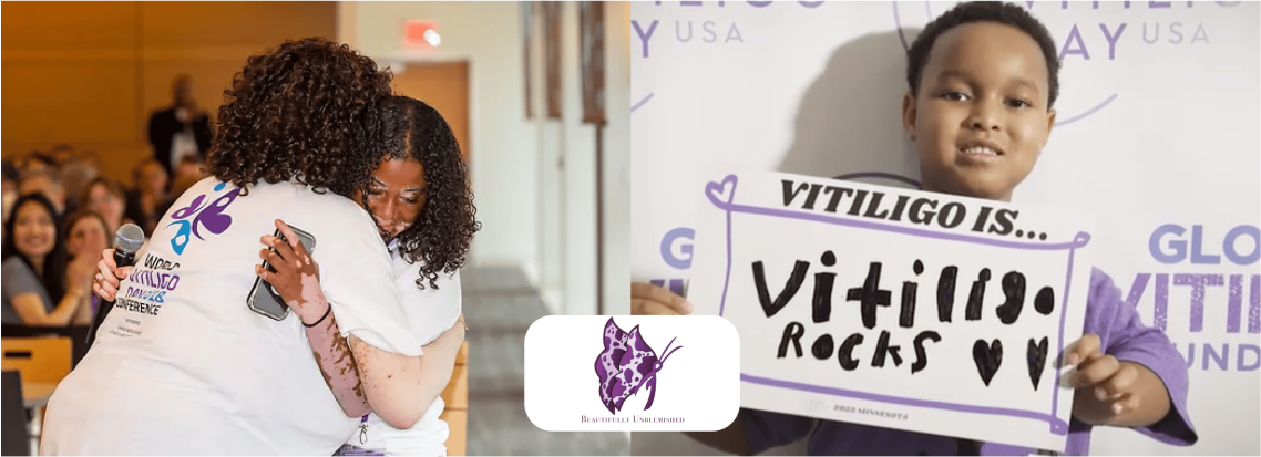 People at a vitiligo awareness event, with a child holding a supportive sign.
