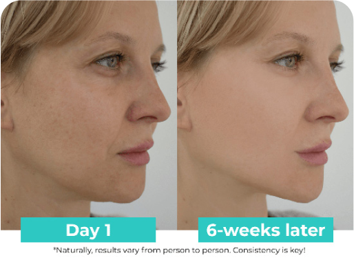 Side-by-side comparison of a woman's face, showing differences over six weeks.