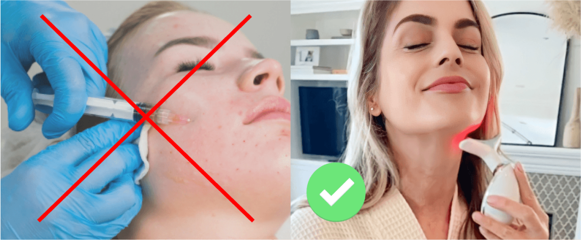 Comparison of cosmetic injection versus using a facial device for skincare.