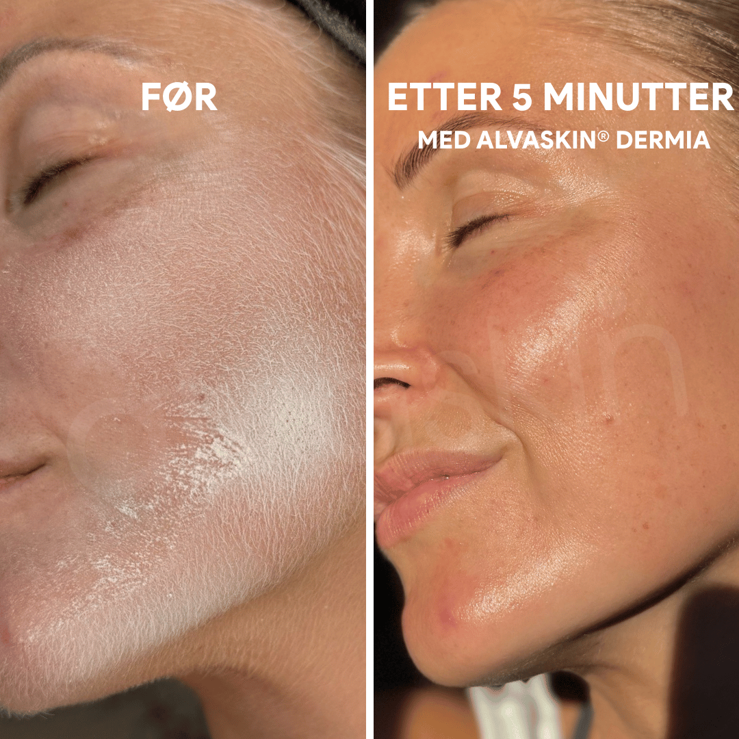 Comparison of textured skin before and smooth skin after using a skincare product.