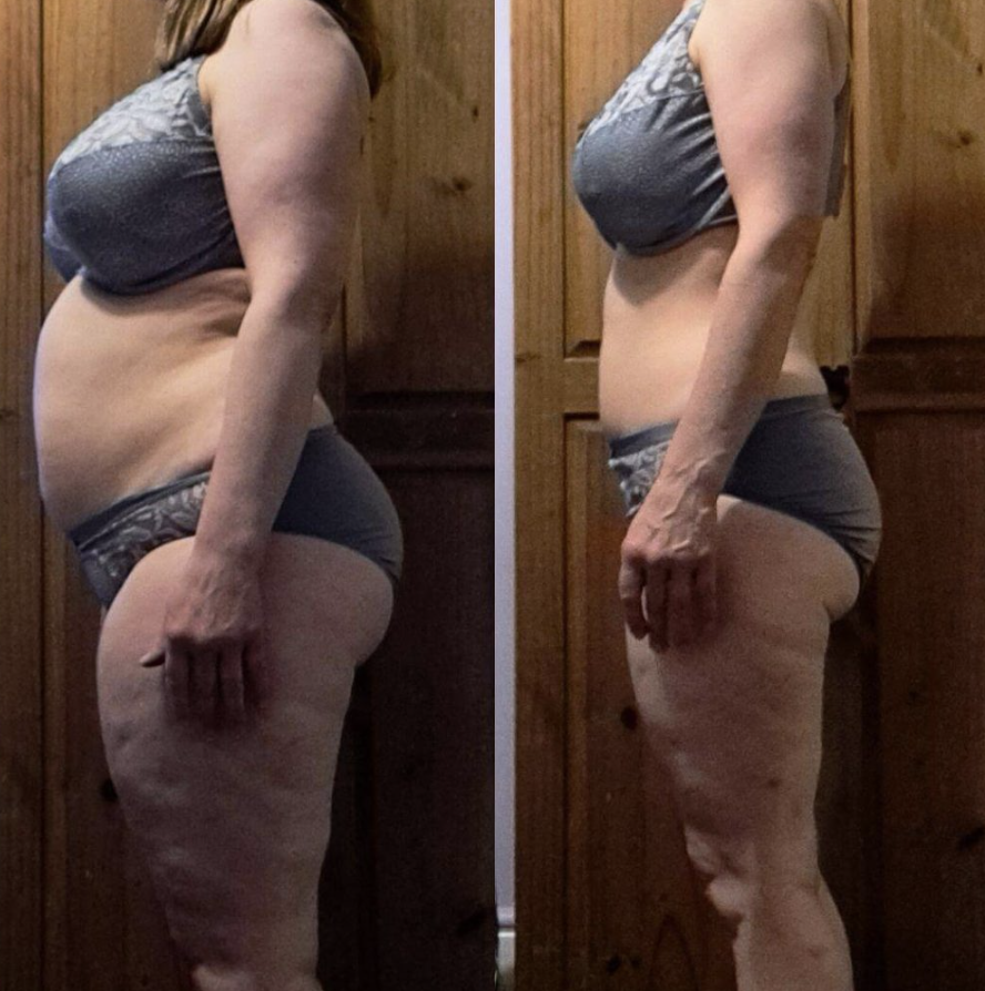 Side-by-side comparison of a woman's body before and after changes.