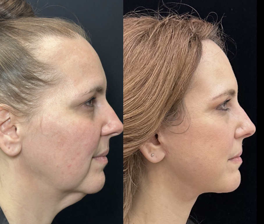 Side-by-side profile photos of two individuals against a black background.