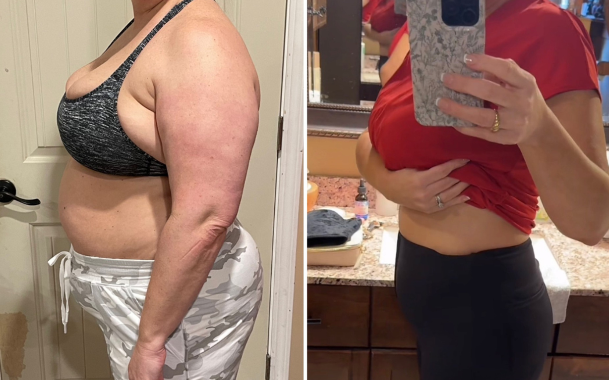 Side-by-side photos showing a person's abdominal changes.