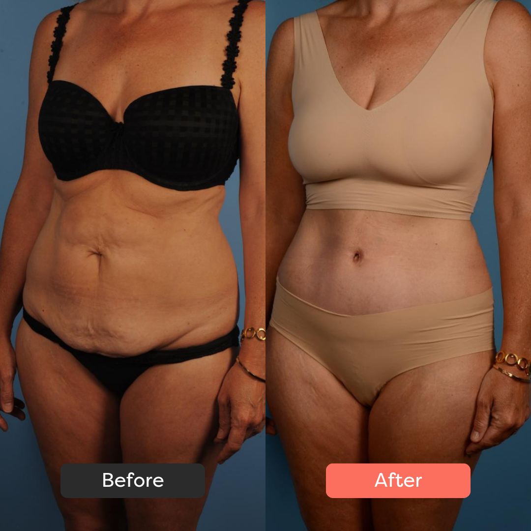 Side-by-side comparison of a woman's body before and after a transformation.