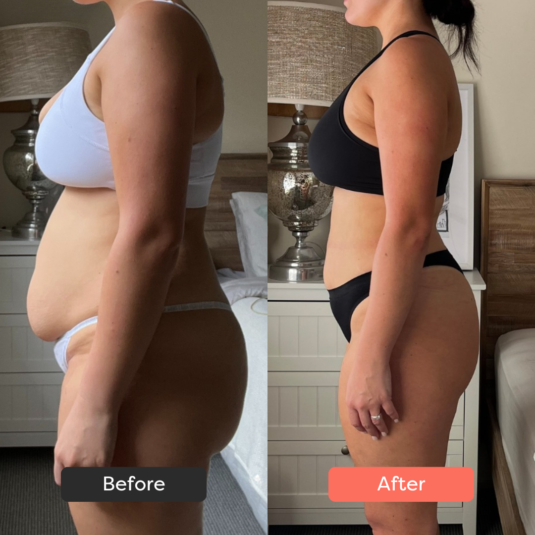 Side-by-side comparison of a woman before and after weight loss.
