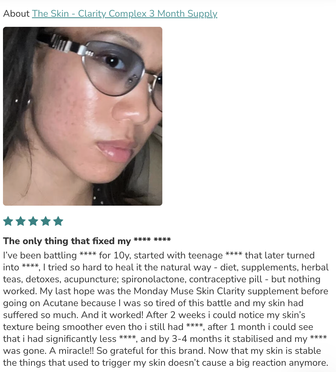 A close-up of a person wearing glasses, showing the texture of their skin.