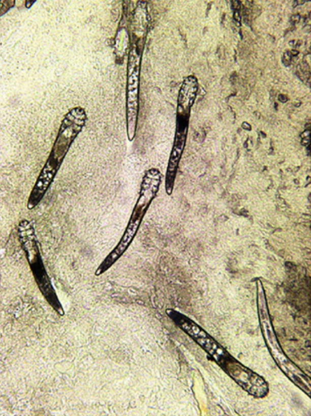 Microscopic view of several elongated microorganisms on a textured surface.