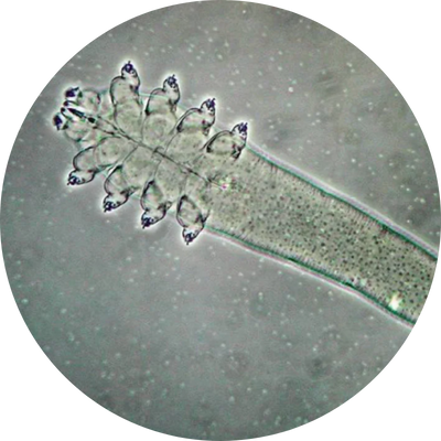 Microscopic view of a transparent, segmented organism with multiple tentacle-like structures.