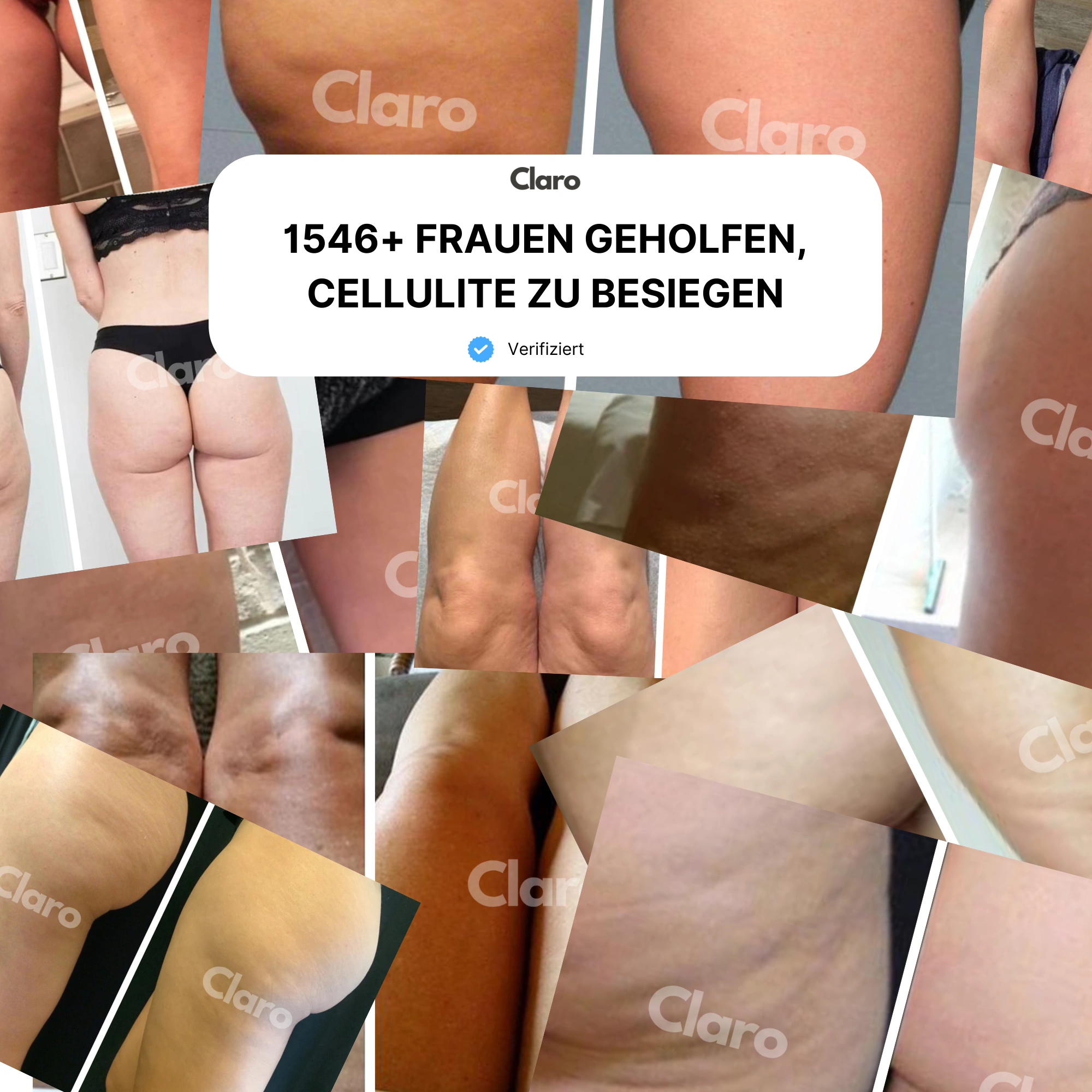 Collage of legs and buttocks with cellulite, text overlay in German.