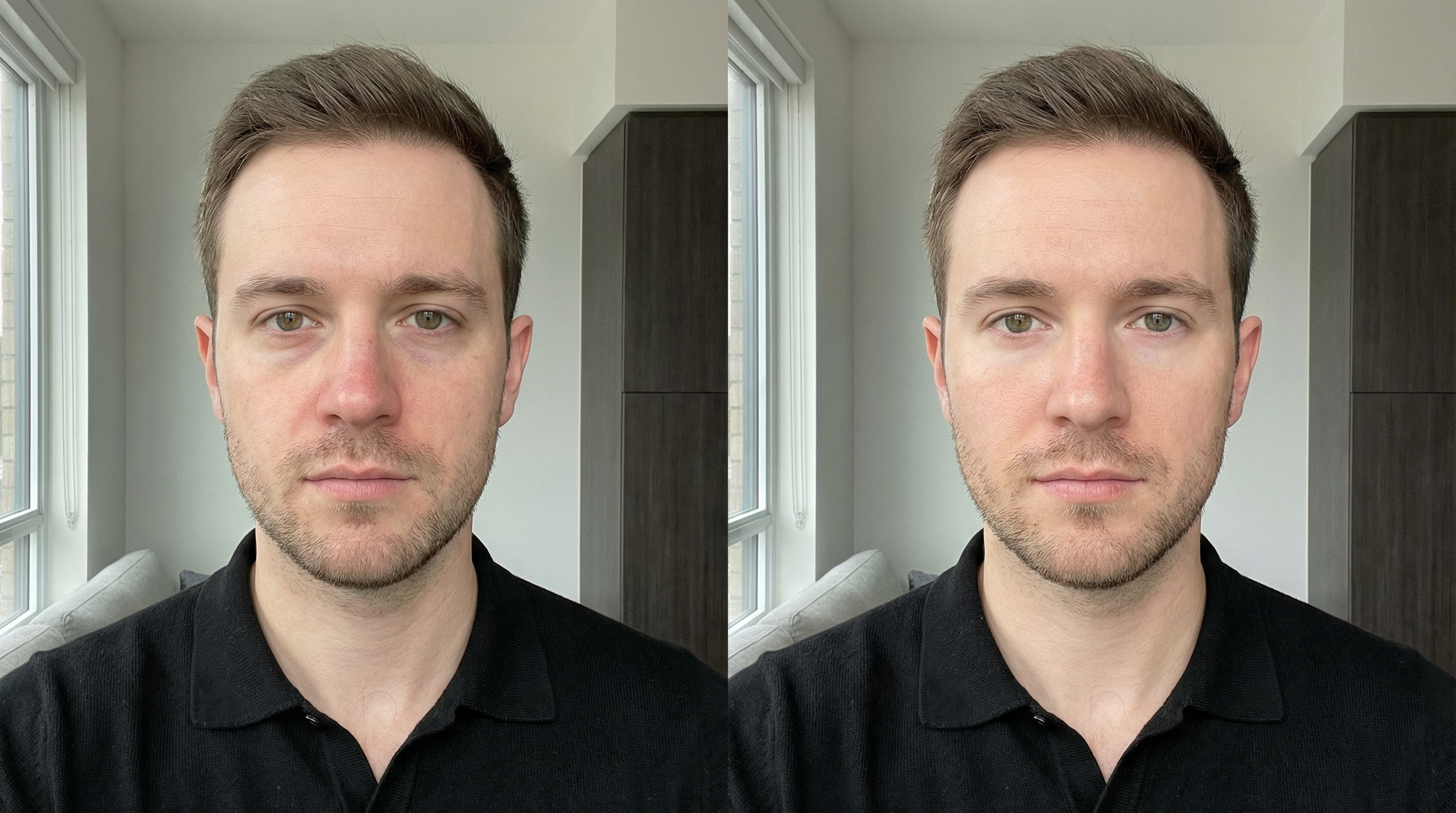 A side-by-side before and after image of a man's face, showing clearer skin on the right.