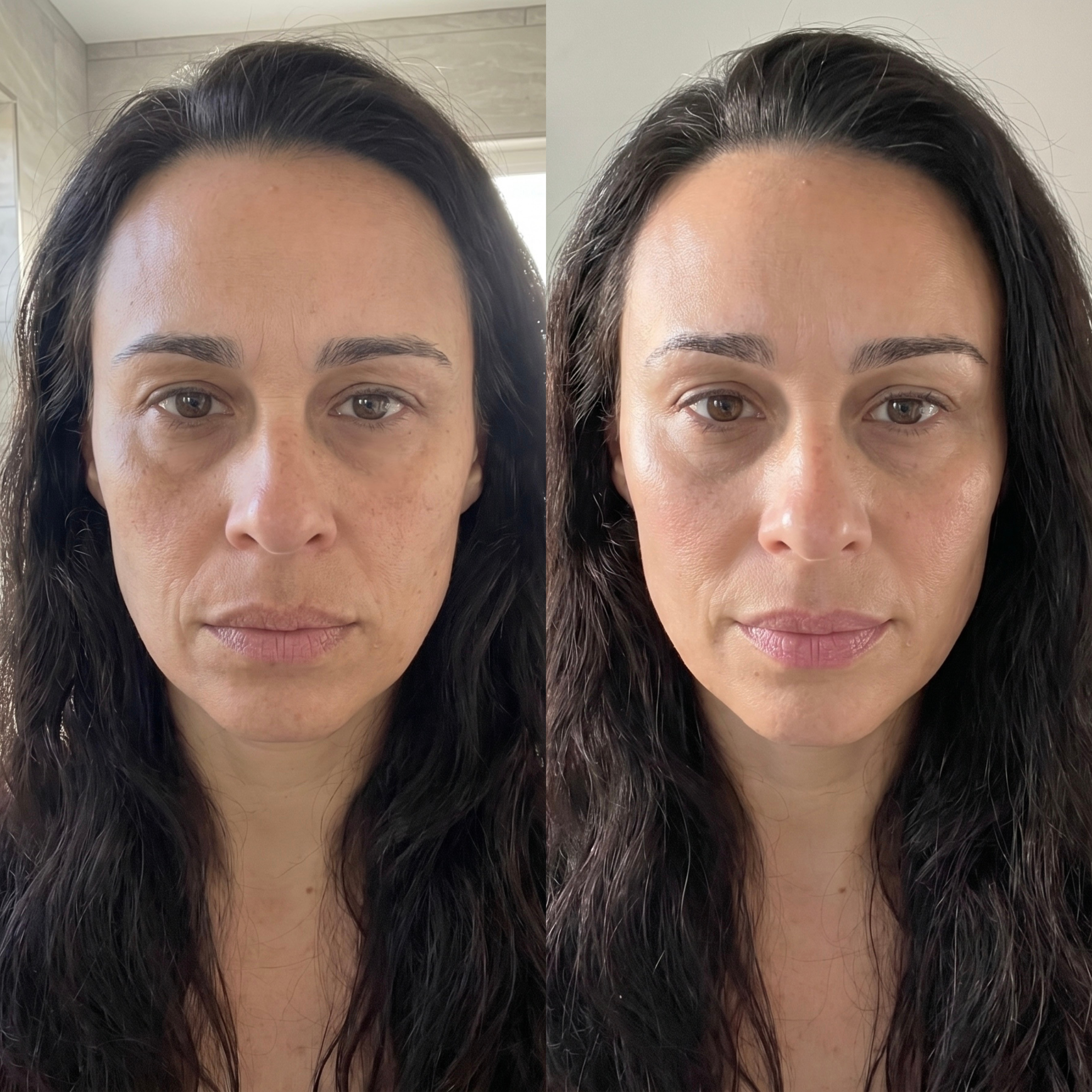 A before and after photo of a woman's face, showing brighter skin and reduced under-eye circles.