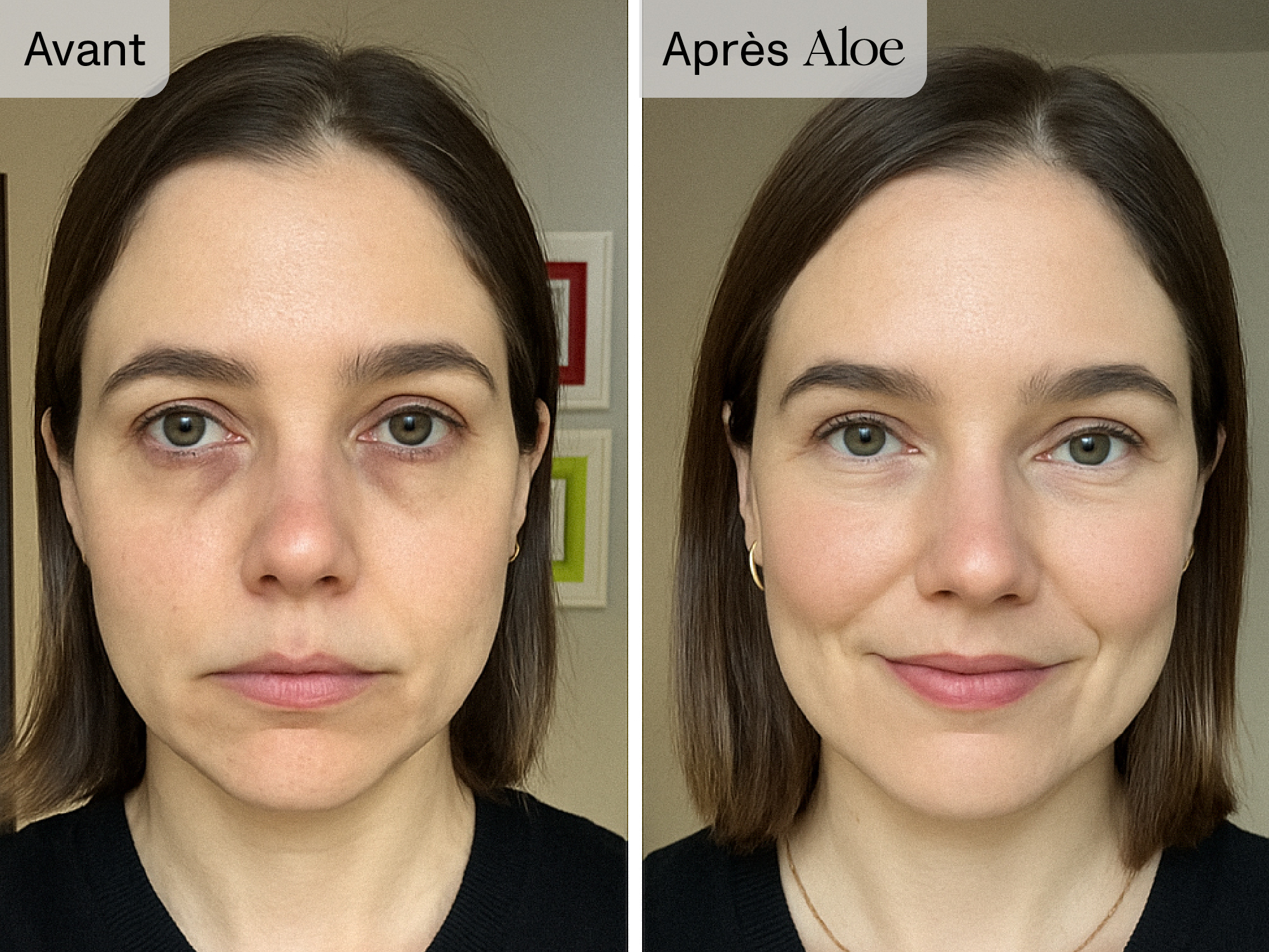 Side-by-side comparison of a woman before and after using aloe.