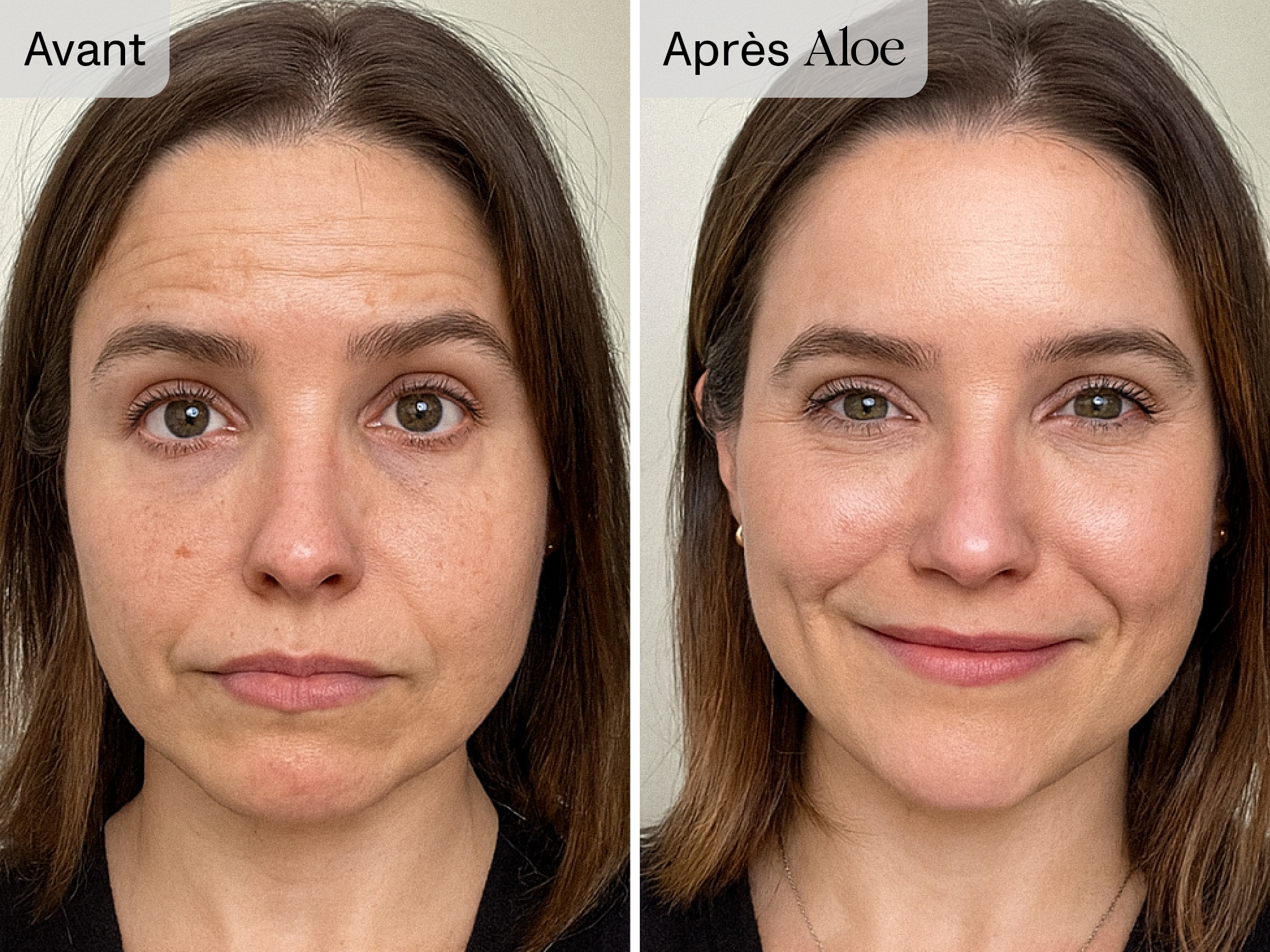 Side-by-side photos of a woman before and after using a product, with noticeable facial changes.