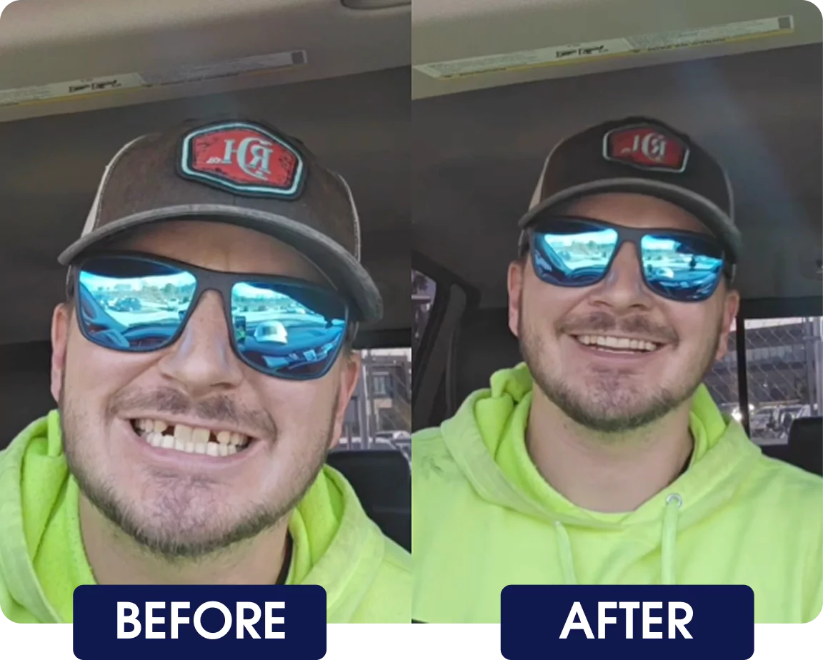 Side-by-side before and after photos of a smiling man in a car.