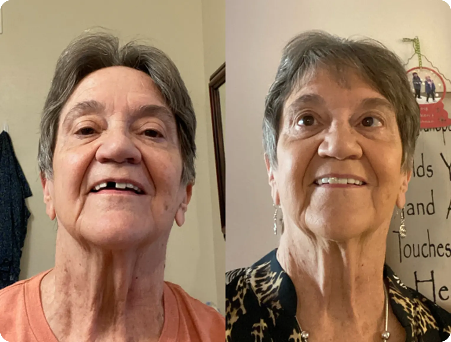 Side-by-side comparison of a woman before and after a change.