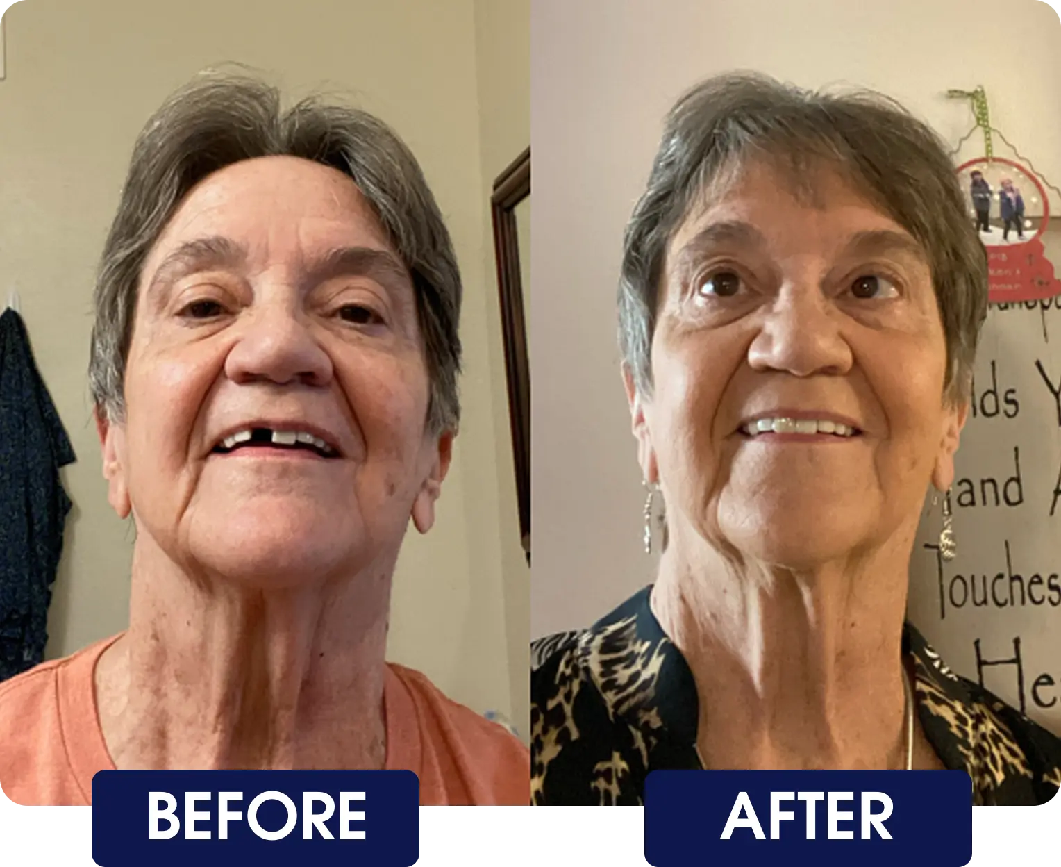 Side-by-side comparison of a woman before and after a change.