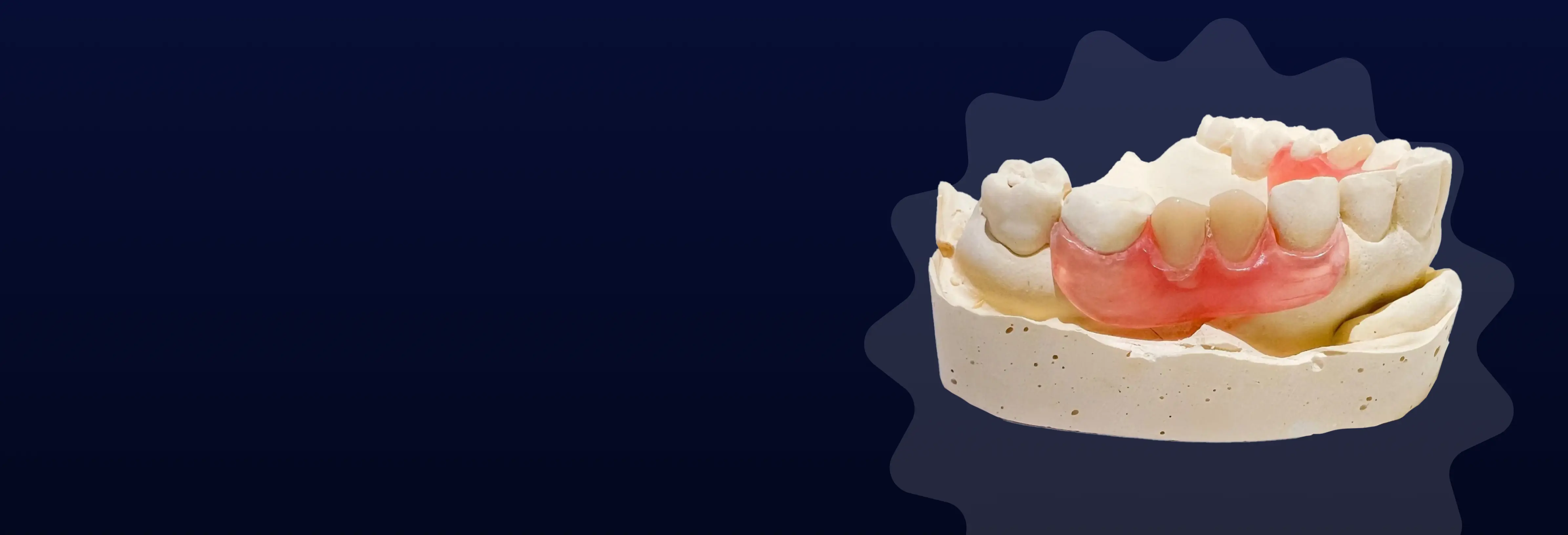 Dental model with teeth and pink gum on a dark background.