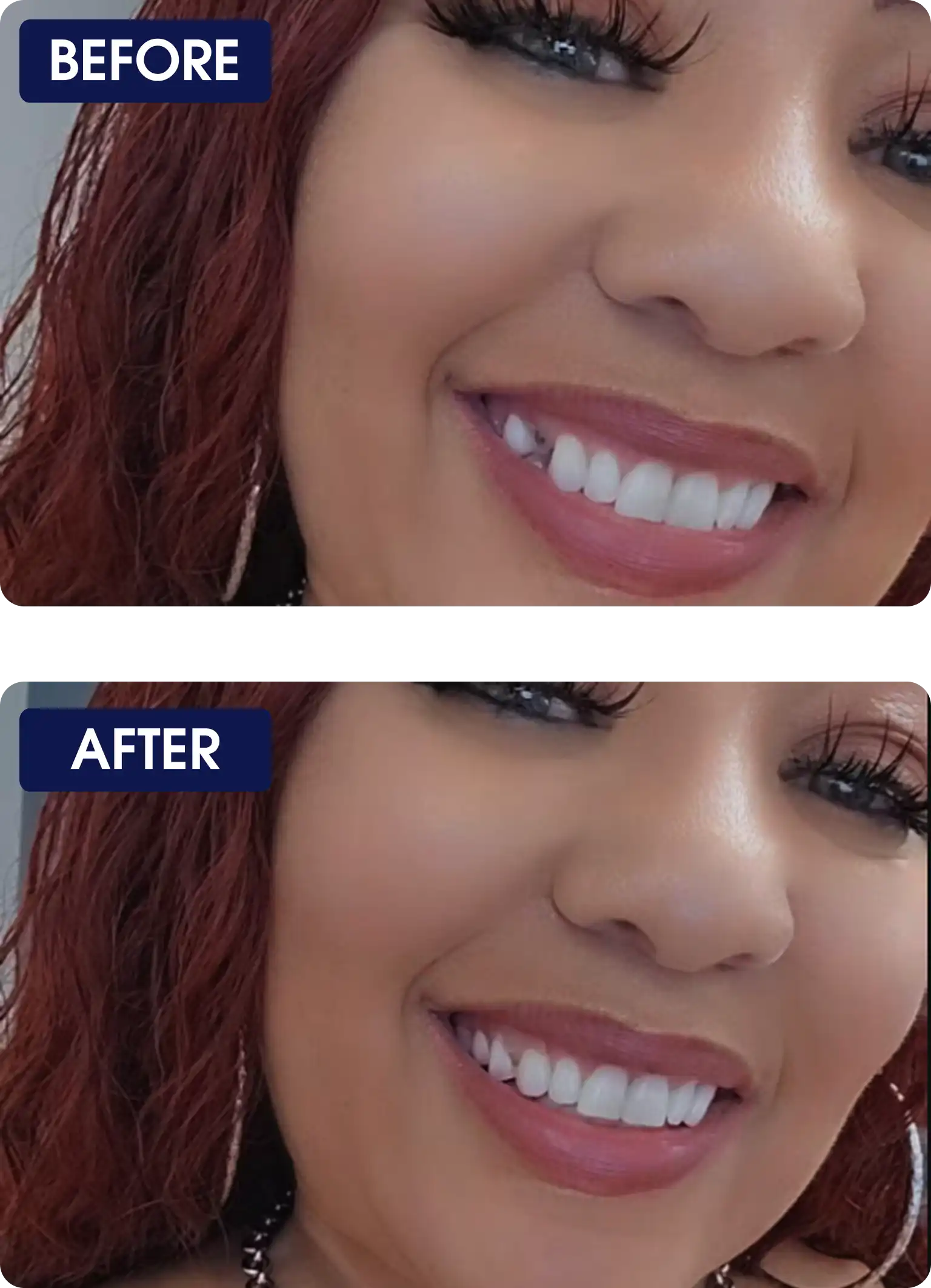 Side-by-side photos showing a smile before and after enhancement.