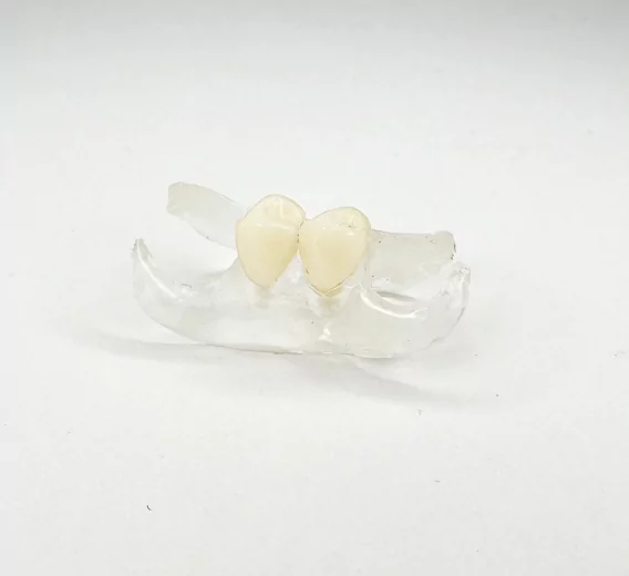 Flexible Partial Denture