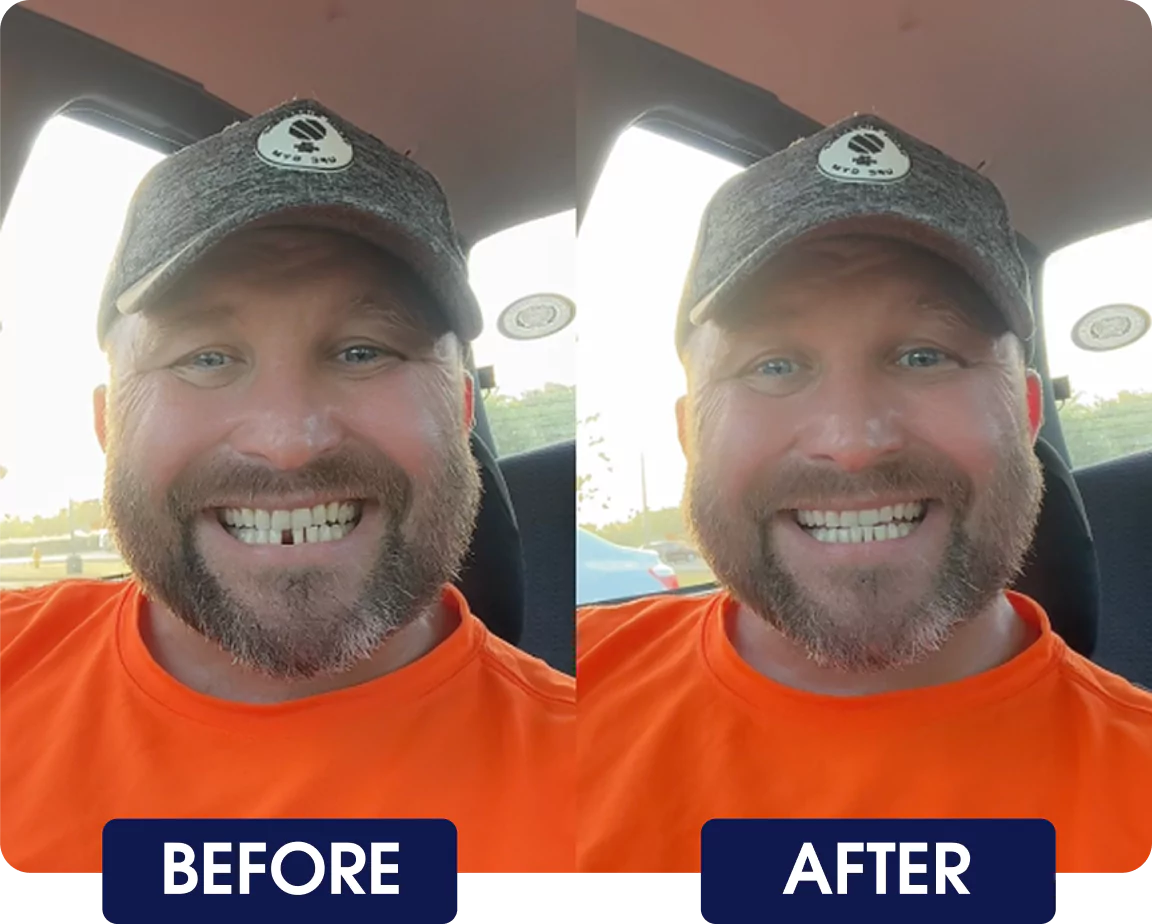 Side-by-side photos of a smiling man in a cap labeled 'Before' and 'After.'