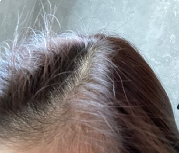 Close-up of a person's scalp with visible hair roots.