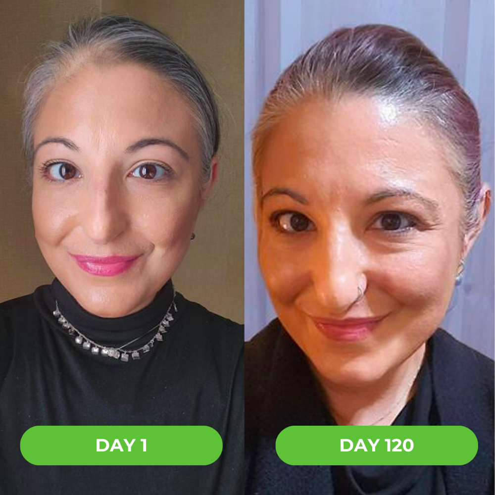 Side-by-side comparison of a woman on Day 1 and Day 120.