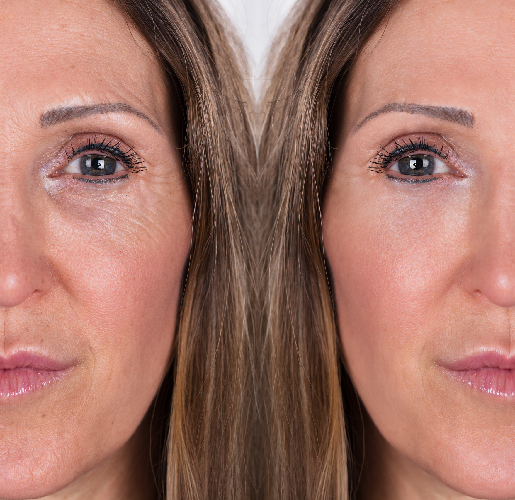 Side-by-side comparison of a woman's face showing skin texture differences.