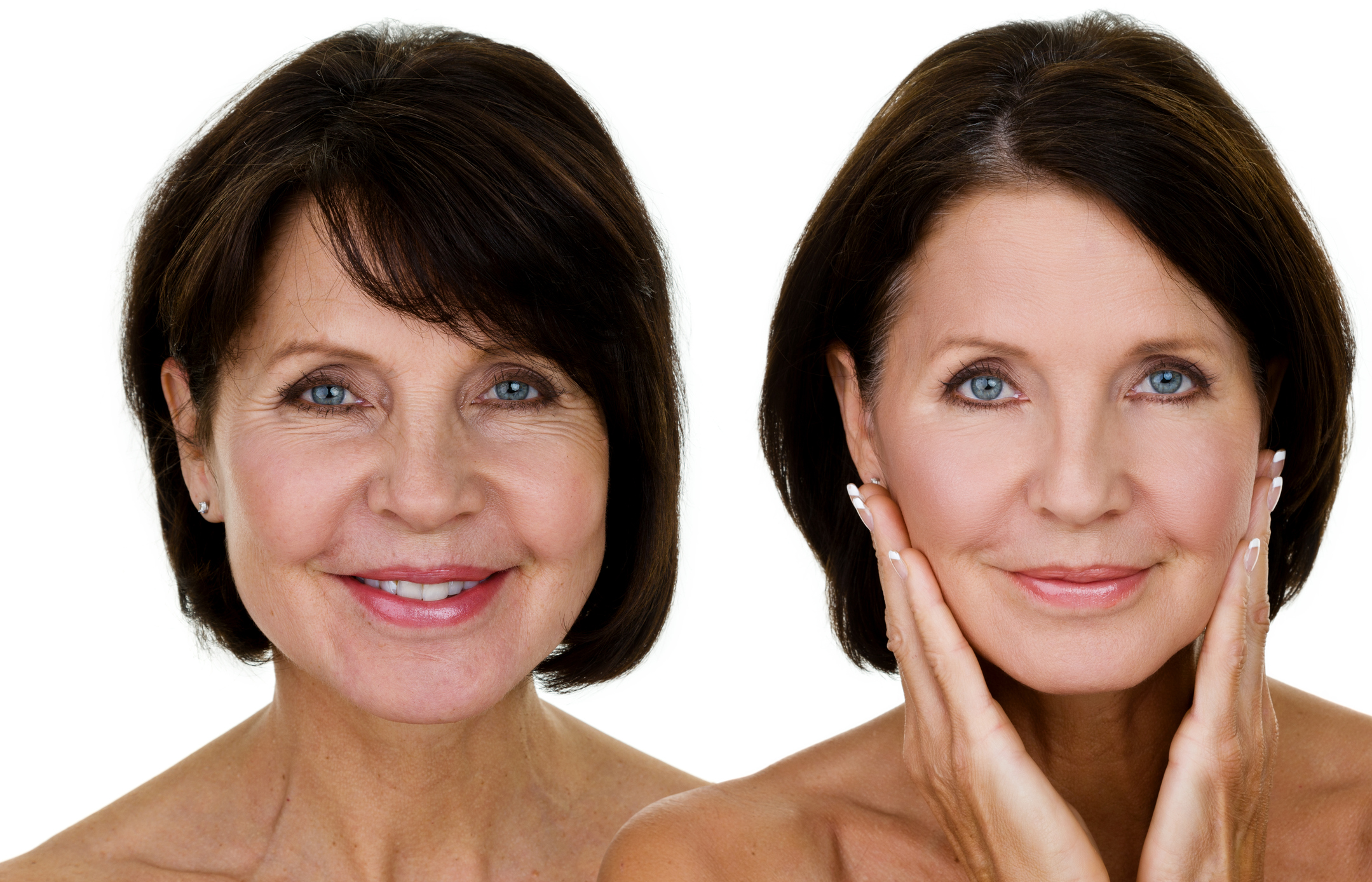 Two images of the same woman, before and after skincare treatment.