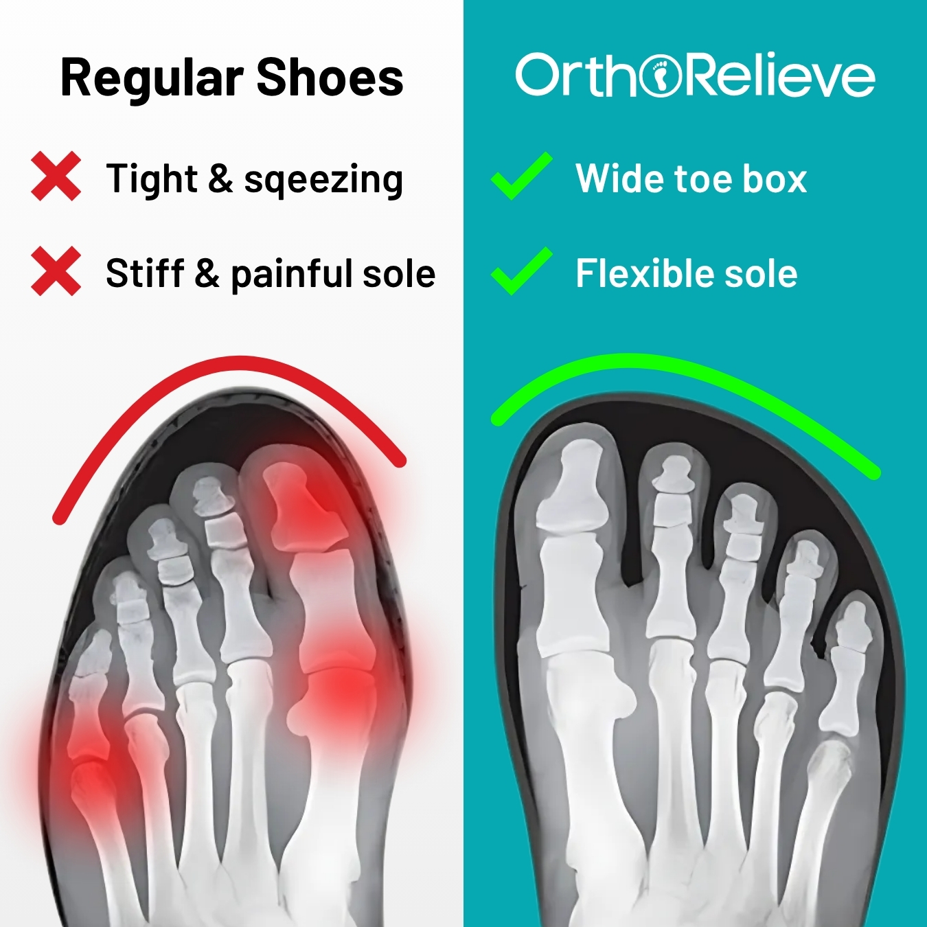 Comparison of foot X-rays: tight vs. wide toe box, regular vs. OrthoRelieve shoes.