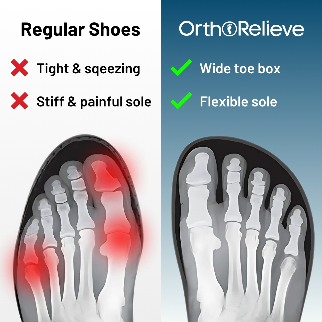 Comparison of regular shoes vs. OrthoRelieve showing foot pressure points.