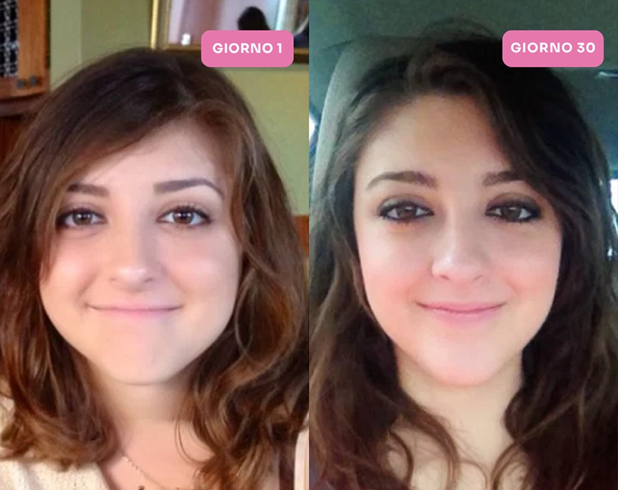 A side-by-side photo comparison of a woman's face, labeled 'Day 1' and 'Day 30'.