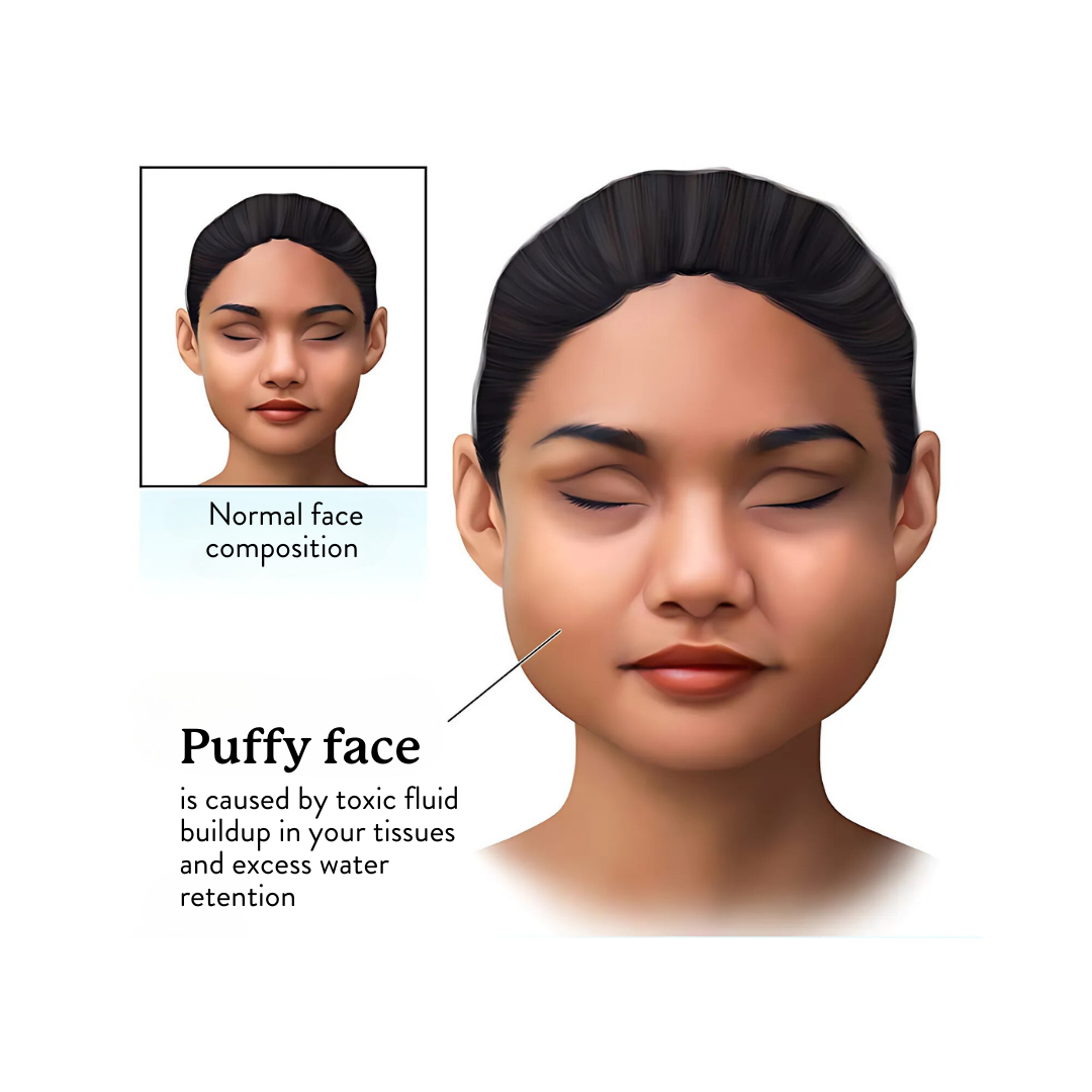Illustration showing normal and puffy faces with text about causes of puffiness.
