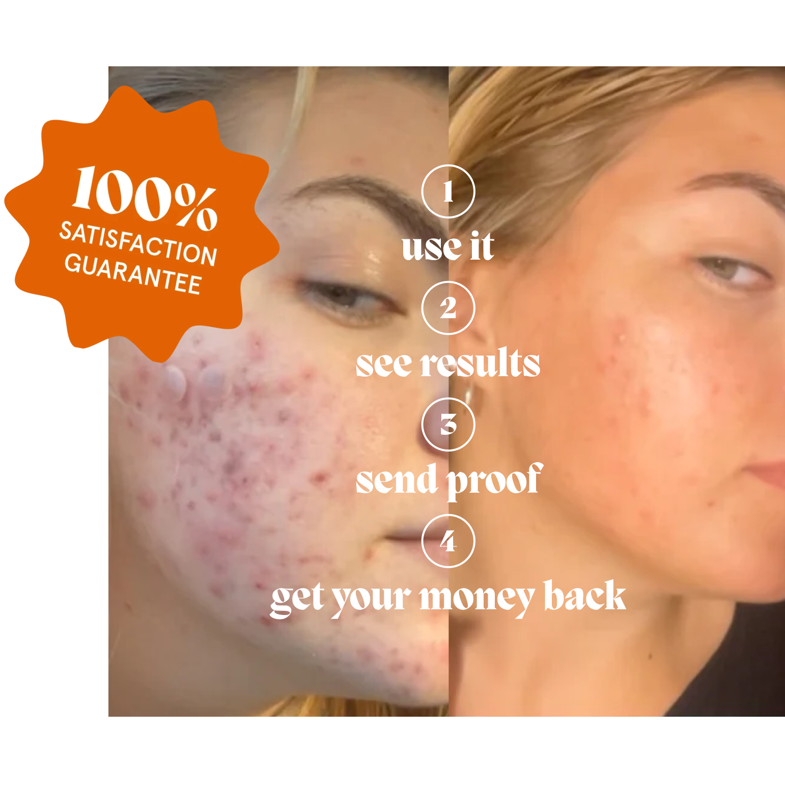 Side-by-side skin treatment before and after photos with satisfaction guarantee badge.