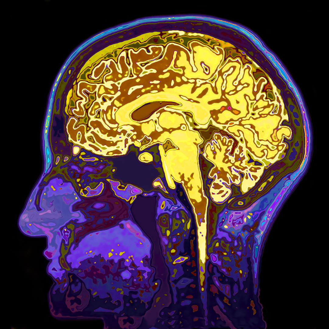 Colorful MRI scan of a human brain in profile view.