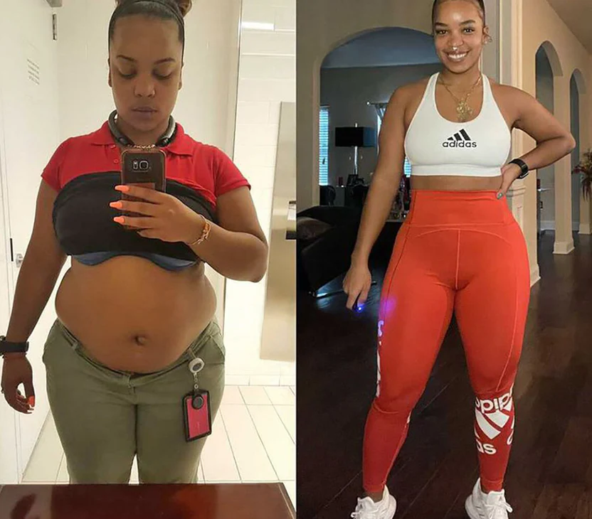 Two side-by-side images showing a woman before and after losing weight.