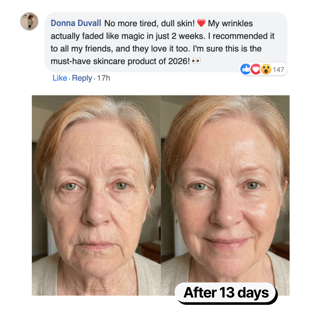A before-and-after image of a woman's face, showing skincare results, paired with a social media testimonial.