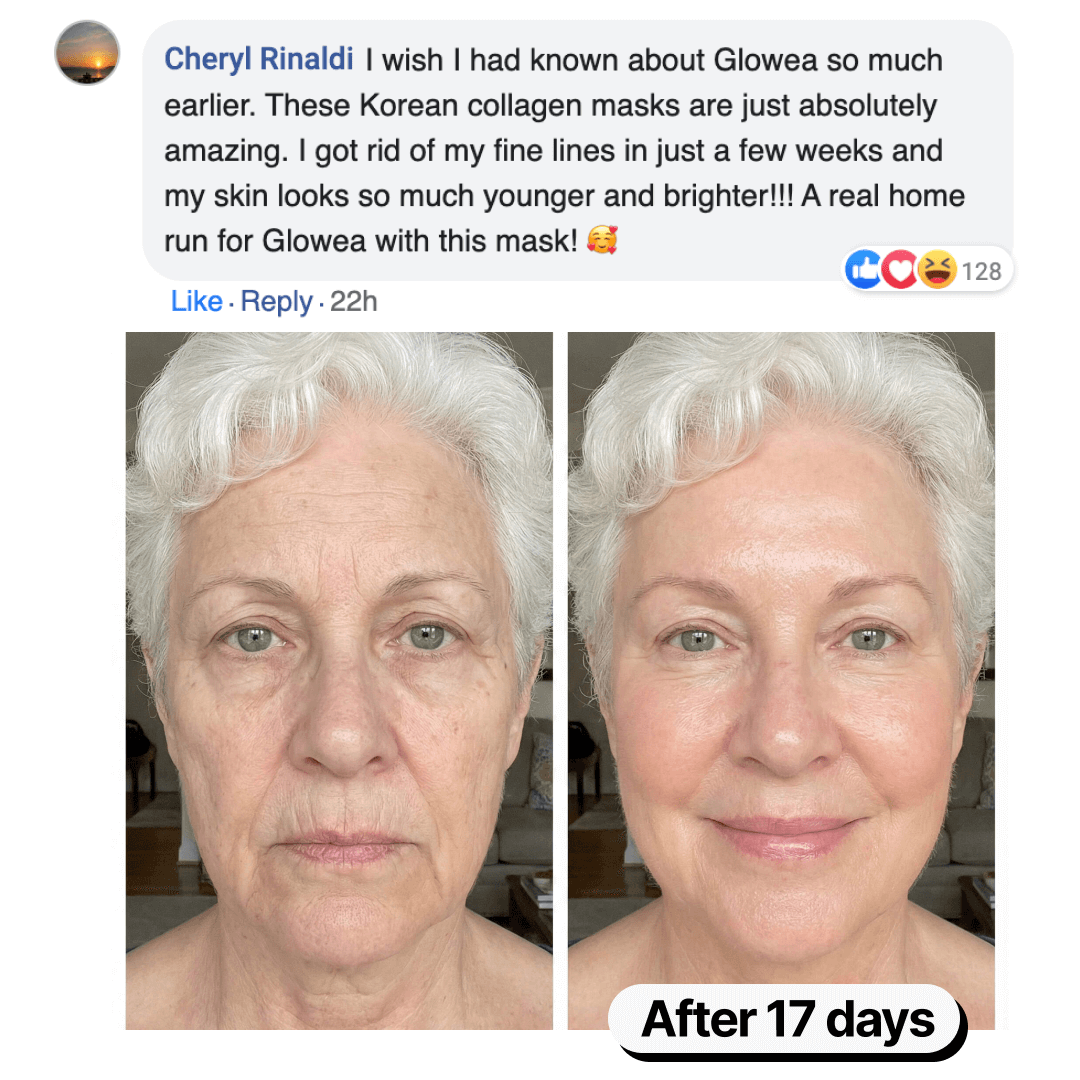 Before-and-after photos of a woman's face showing skin improvement after 17 days, with a positive product review.