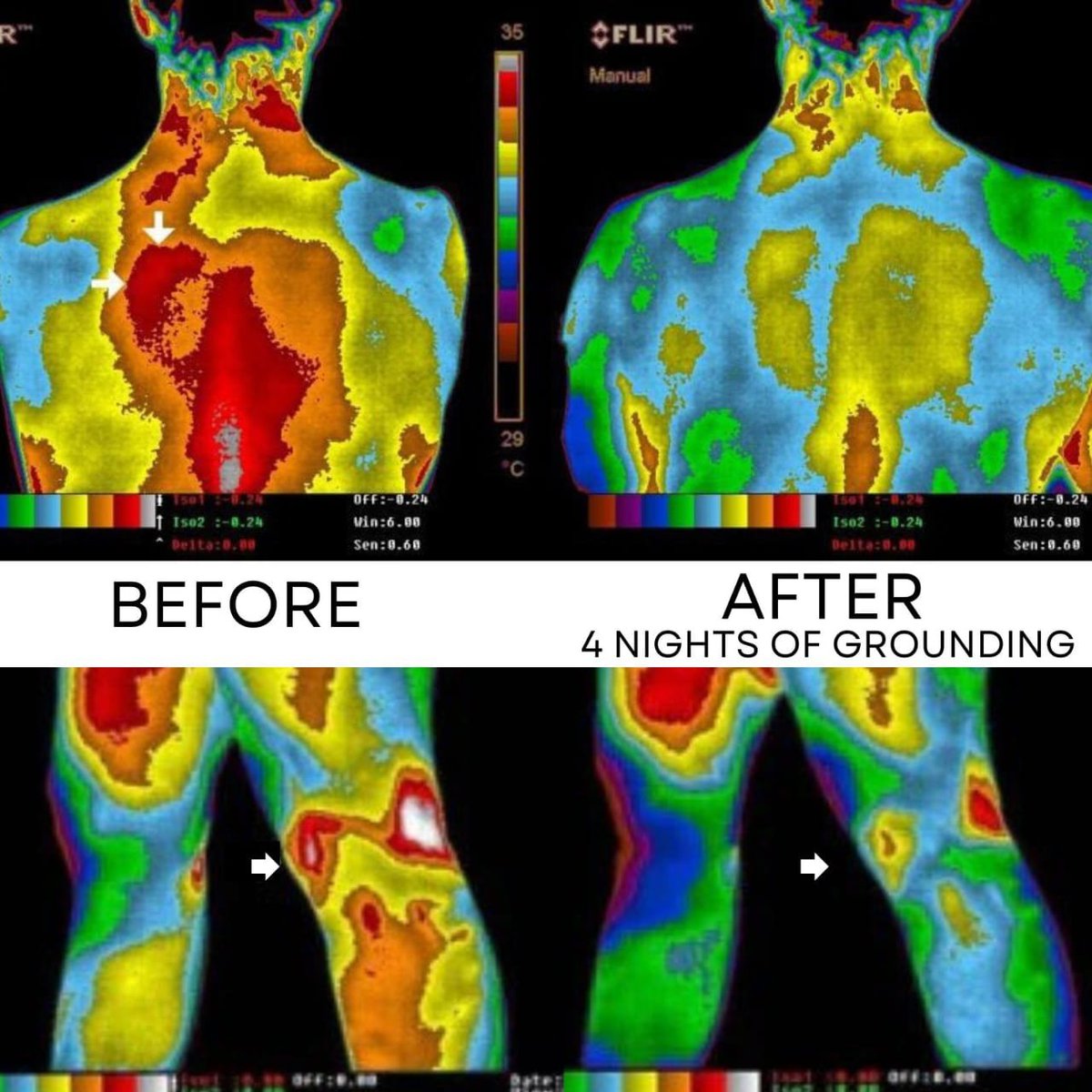 Thermal images of a person's back and legs, labeled 'Before' and 'After' grounding.
