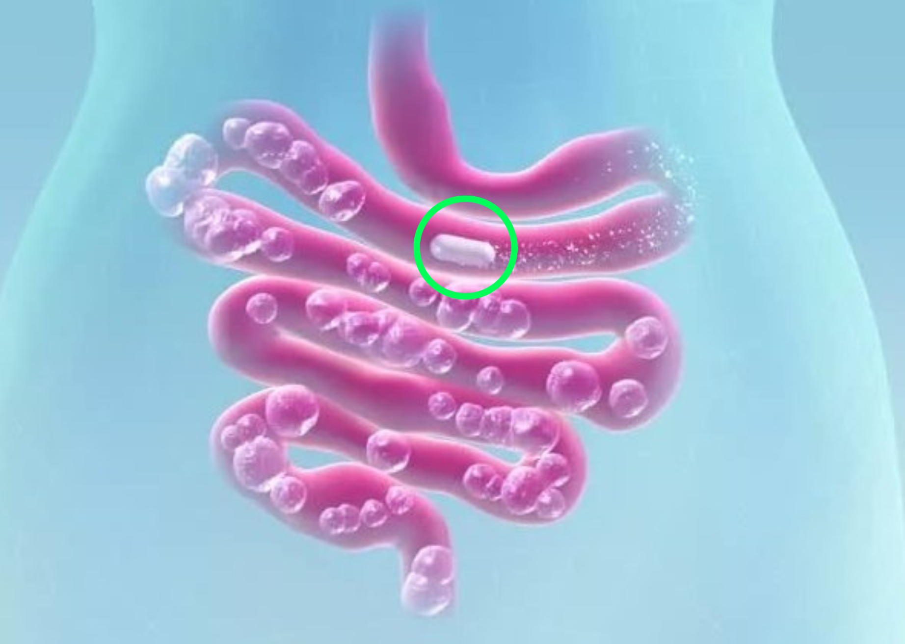 Illustration of intestines with bubbles and a highlighted capsule.