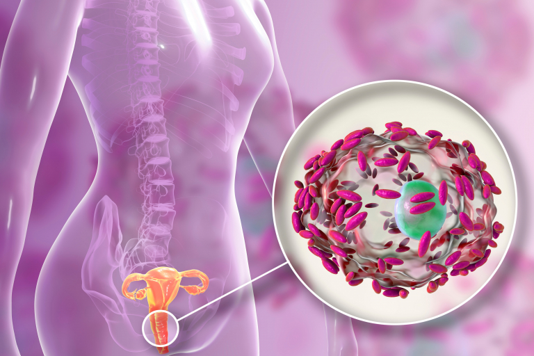 Illustration of female anatomy with a magnified view of bacteria in the reproductive system.