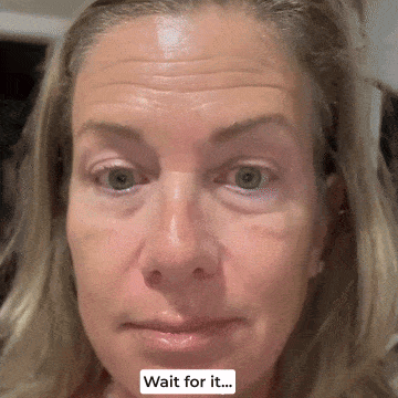 Person applying eye cream from a tube, expression changes slightly.