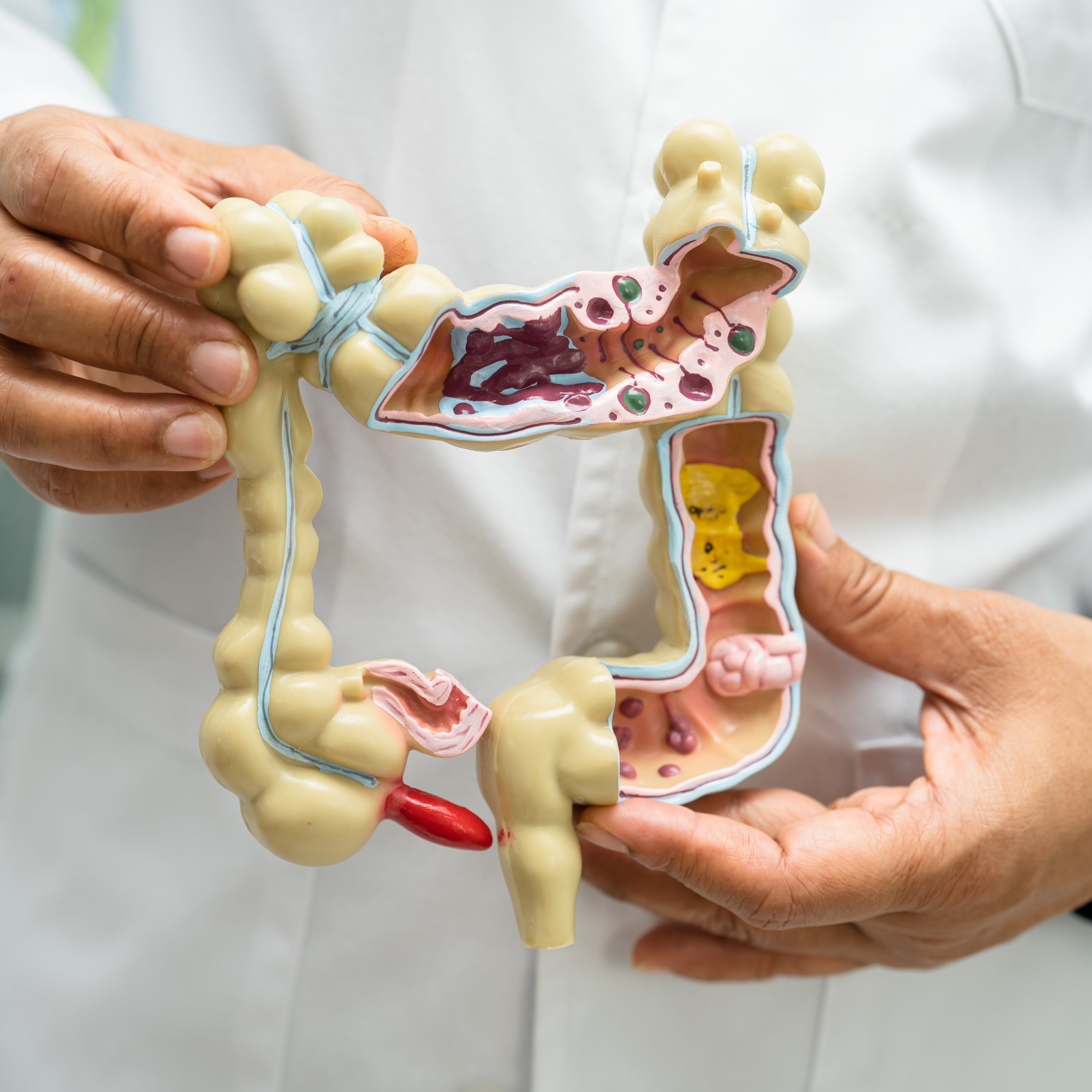 Person holding a model of the human colon.