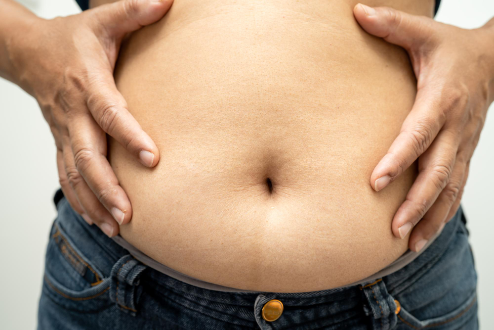 Bloating