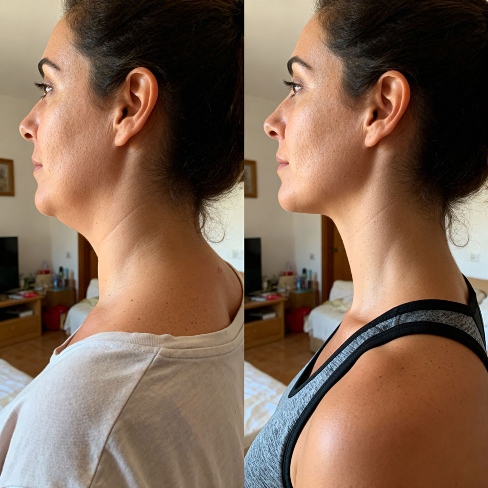 Before After 2