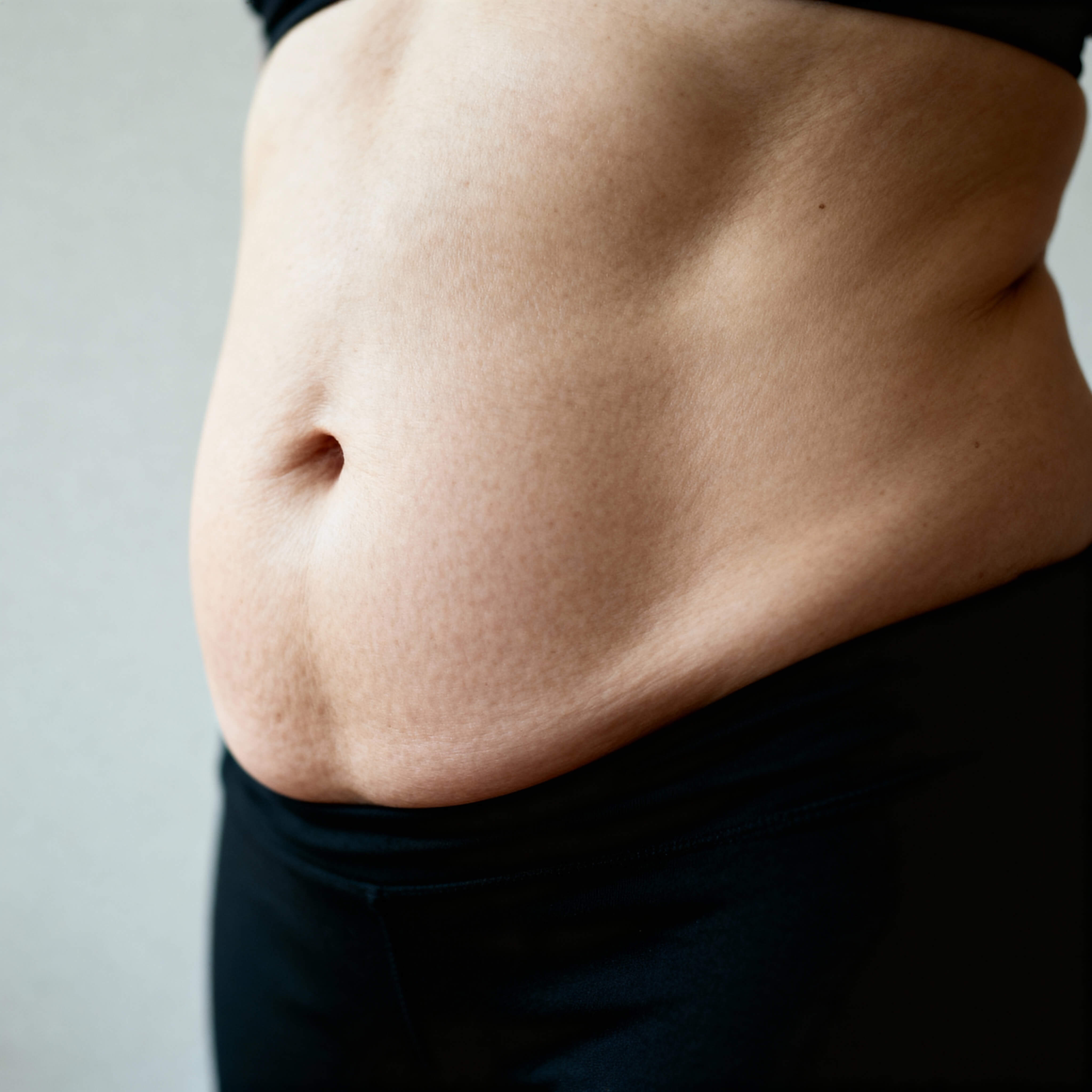 Belly Fat