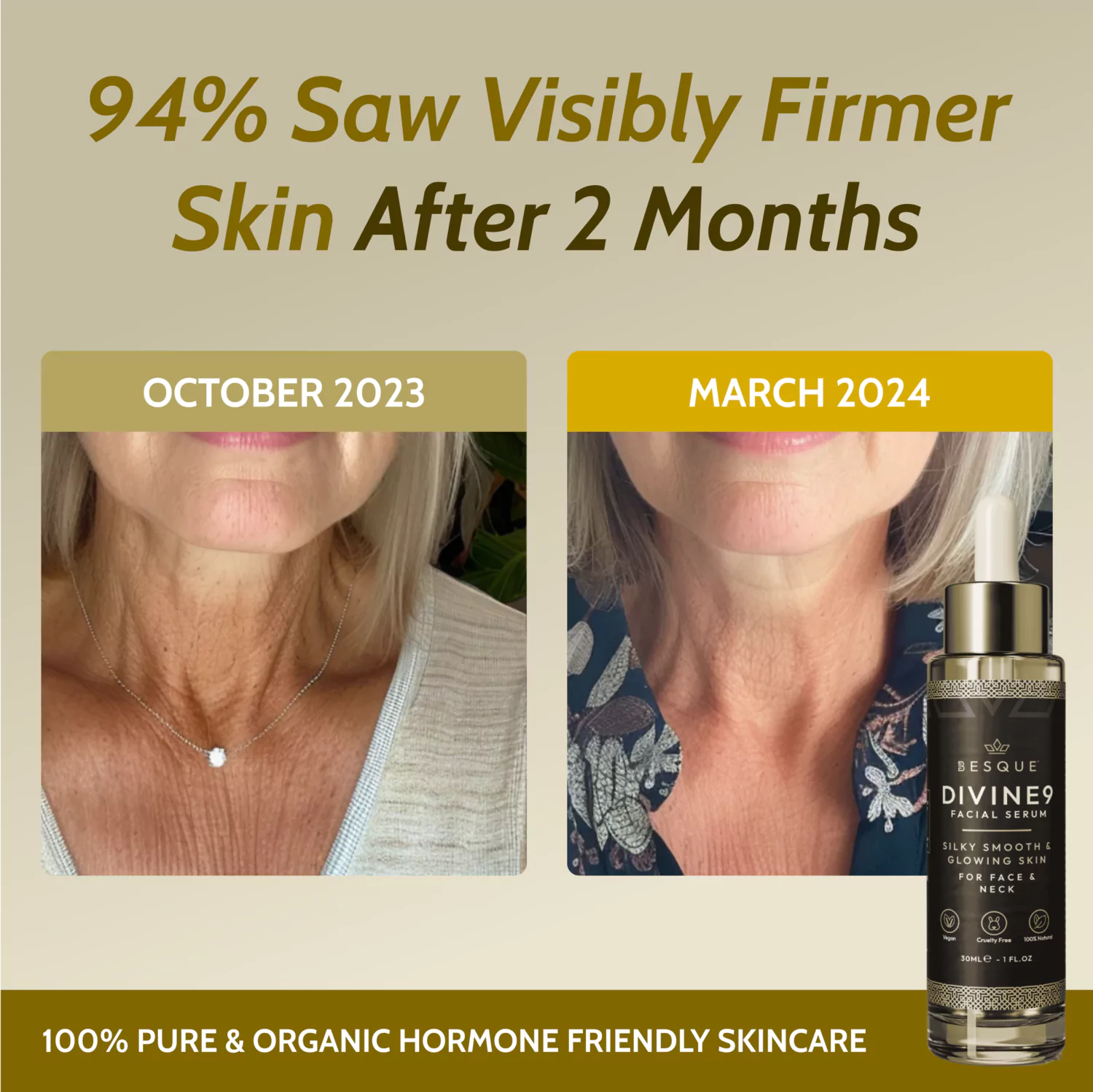Before and after comparison of skin firmness using skincare serum.