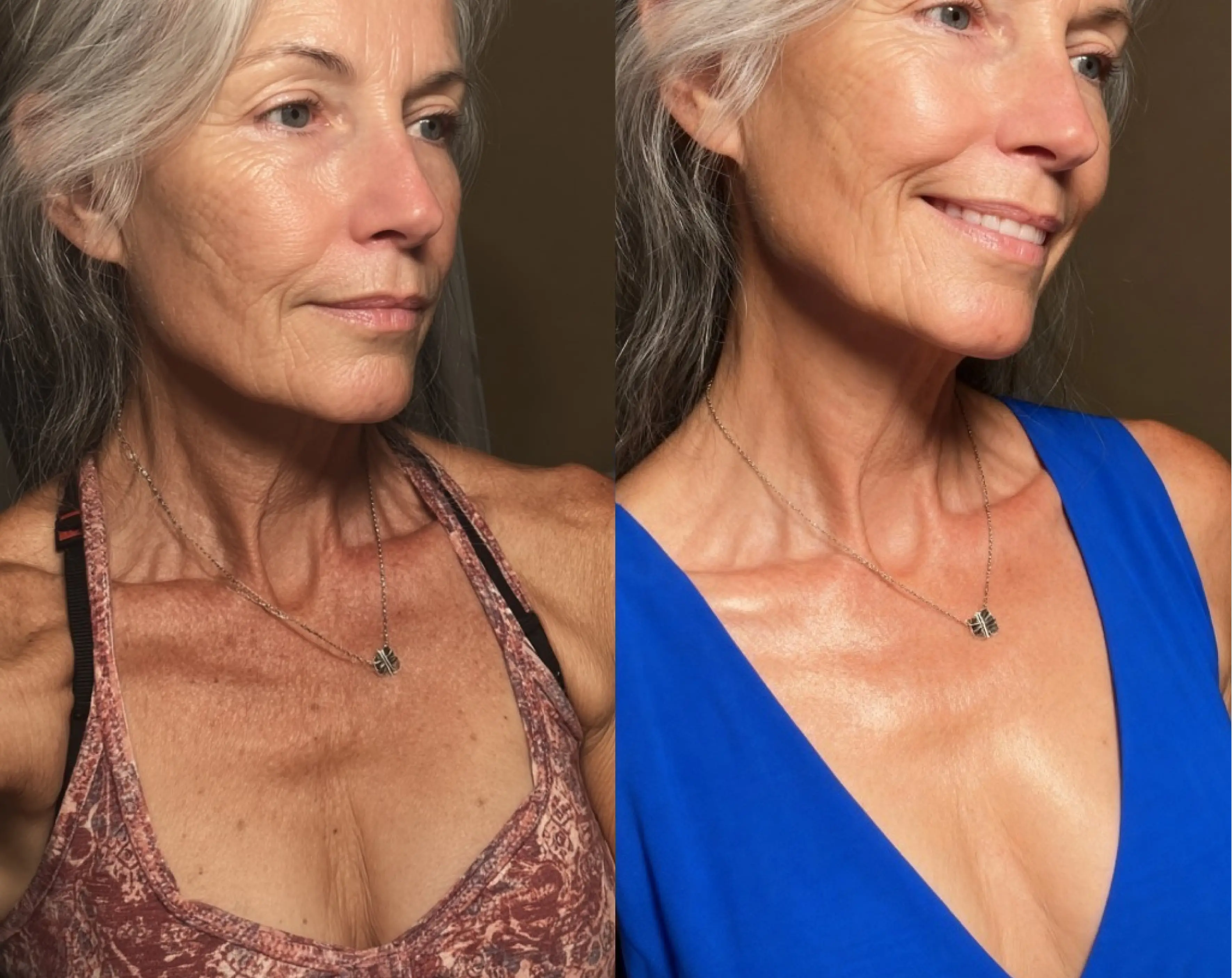 Two side-by-side images of a woman wearing different outfits, showing before and after effects.