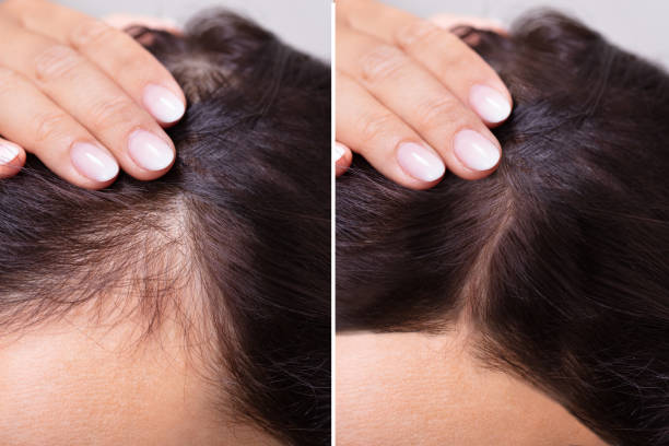 Two images showing hair with different levels of thickness.